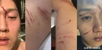 女艺人被男友用*爱性**视频威胁：还有多少人在用舆论给罪犯脱罪？