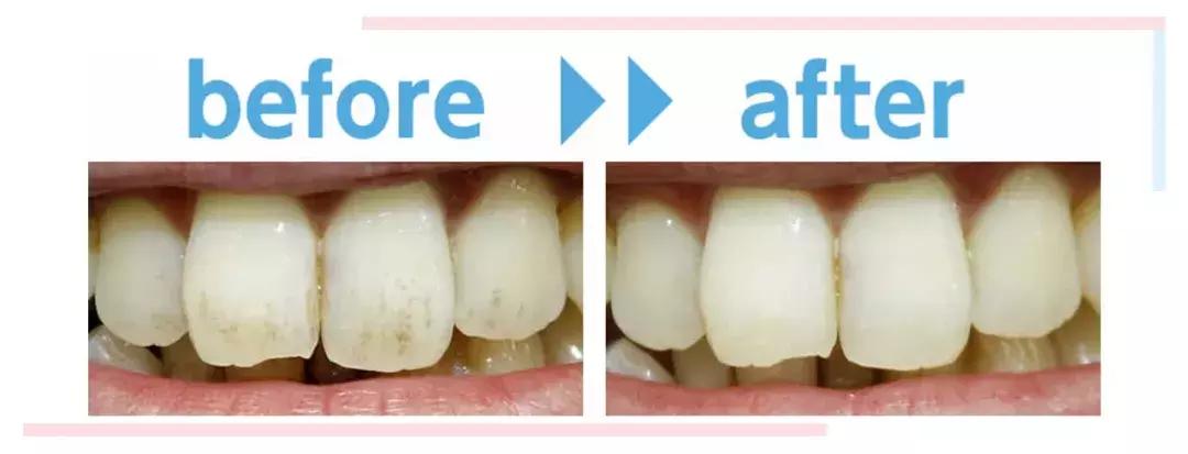 囧！天仙脸配上大黄牙，这是什么操作？！