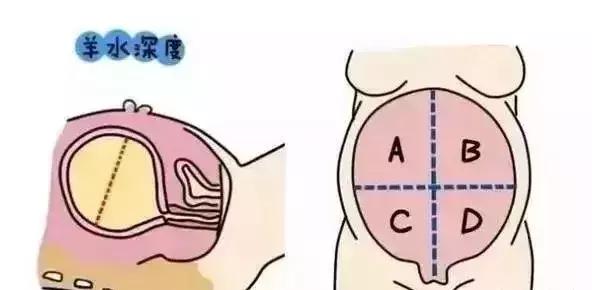 羊水为什么叫羊水秒懂知识,12周羊水什么样子