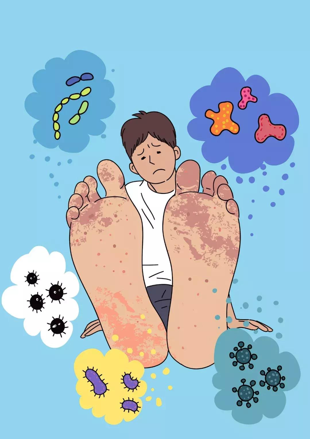 脚气犯了怎么办,脚气用错药导致红肿怎么办