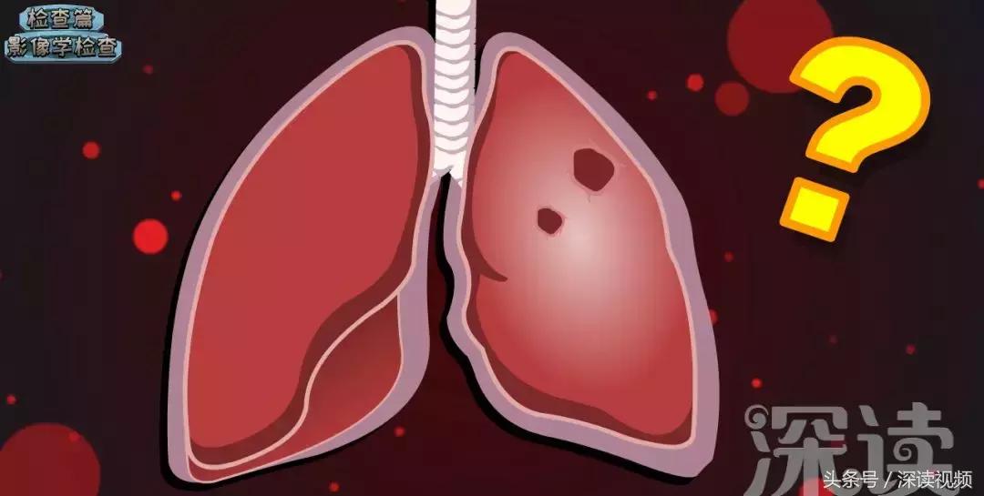 咳嗽低烧37.1-37.5要警惕,咳嗽低烧警惕四种病