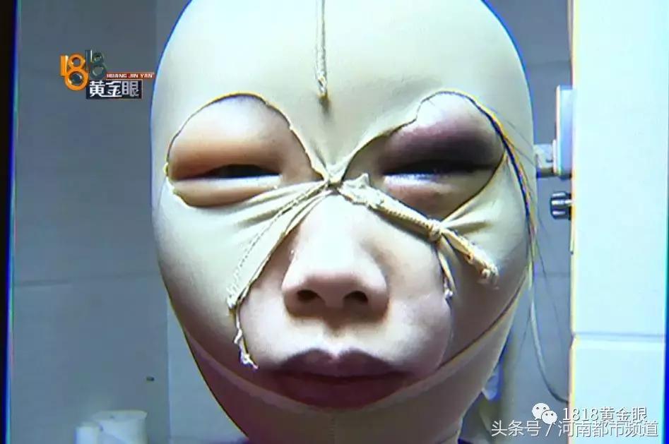 为什么我做溶脂瘦脸都没效果,溶脂瘦脸4天了没有效果