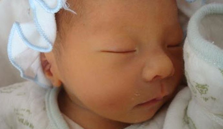 求助宝宝53天黄疸未消退怎么办,宝宝黄疸40天不退要做哪些检查