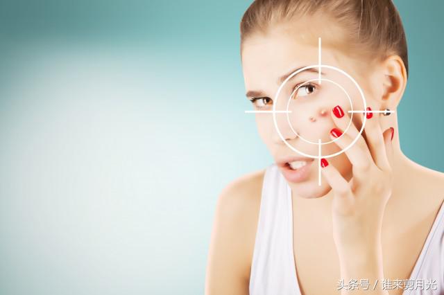 额头太阳穴下巴长痘是什么原因,四十岁了额头和下巴起痘怎么回事
