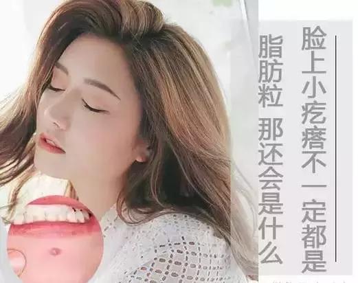 儿童脸上长一粒粒小疙瘩像脂肪粒,宝宝脸上起的类似脂肪粒的疙瘩
