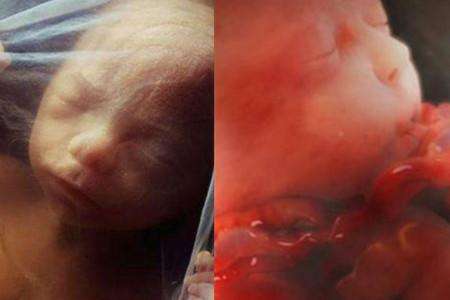 胎儿缺氧孕妇会有什么表现,胎儿缺氧孕妇有什么症状和表现