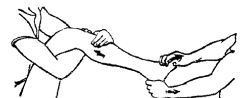 中医骨折治疗原则,中医骨伤整复术