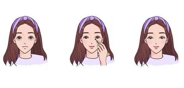 黑眼圈太重怎么消除熊猫眼,黑眼圈怎么消除不伤眼