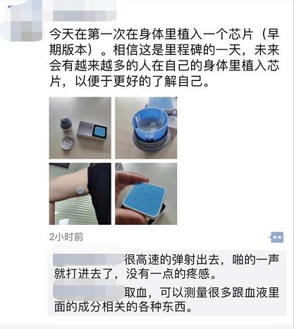 体内植入定位芯片,体内植入微型芯片