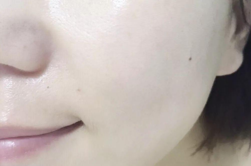 有了这瓶“液体黄金“,今年秋冬注定与干燥、长痘无缘了!