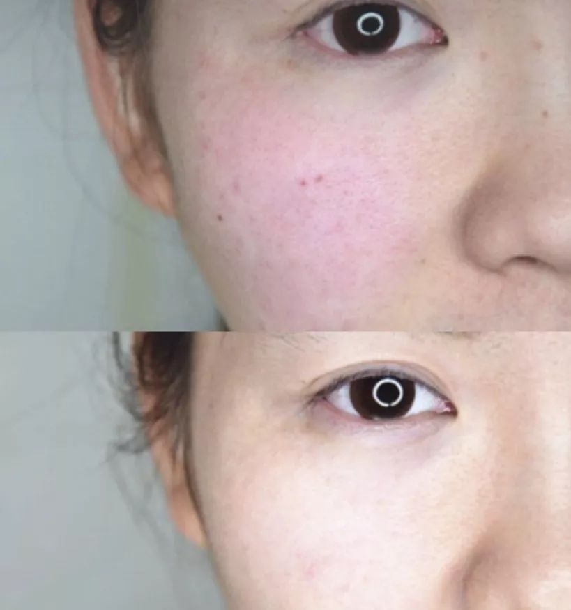 有了全世界3秒卖一瓶的“液体黄金“，干燥、长痘就与你无缘了！