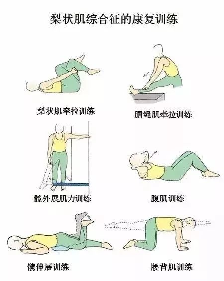 梨状肌综合征的治疗手法视频,梨状肌综合征治疗手法视频