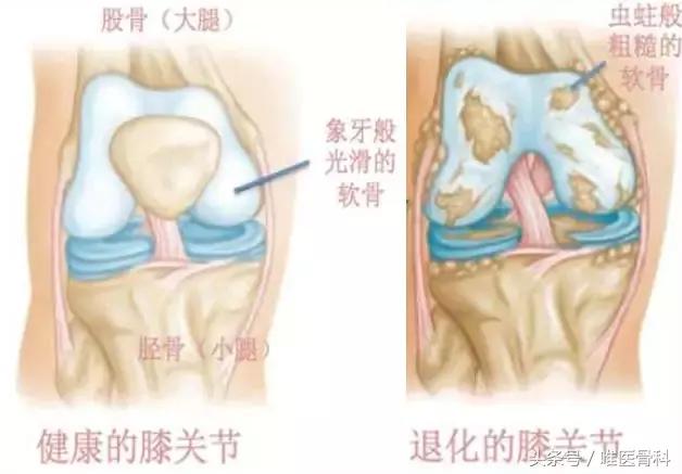 膝盖锻炼方法中老年,老年人膝盖疼怎么练腿部肌肉