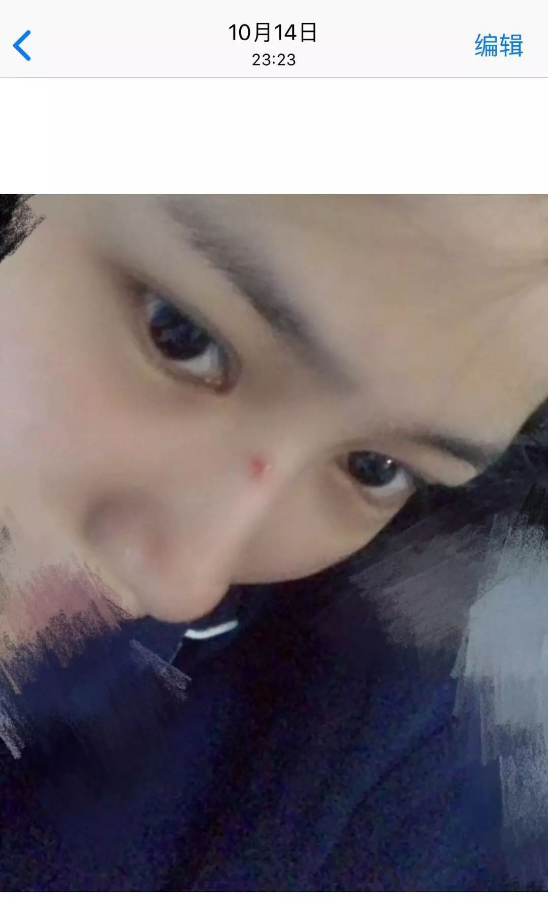 脸上磕伤了涂什么不会留疤,脸上蹭伤如何不留疤