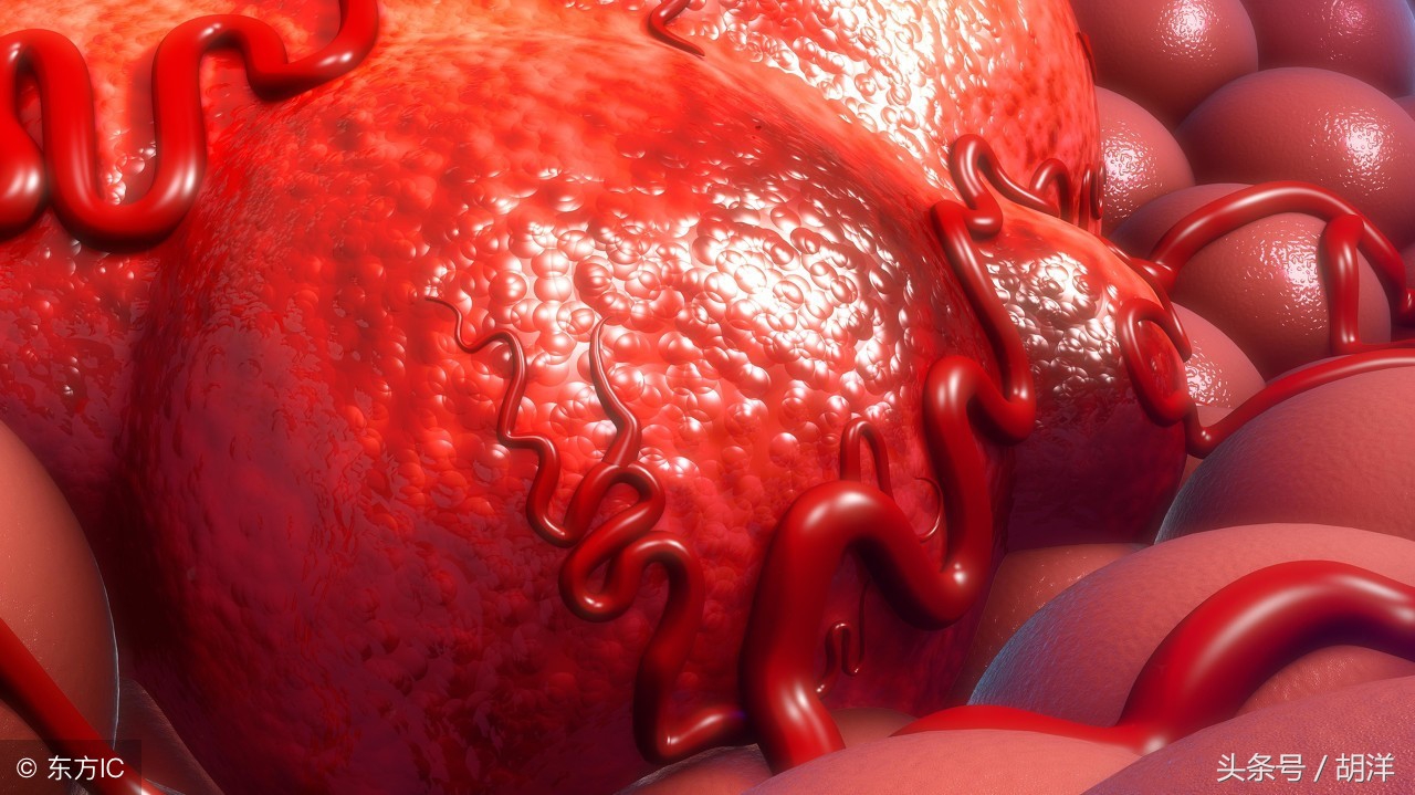 肺癌晚期是不是没希望了？医生：如果是这1种，基本100%治愈