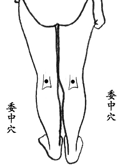 老中医治腰椎间盘突出立刻见效,火灸对腰椎间盘突出有效吗