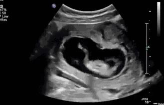 22周胎儿在肚子里的视频,22周胎儿在腹中真实照片