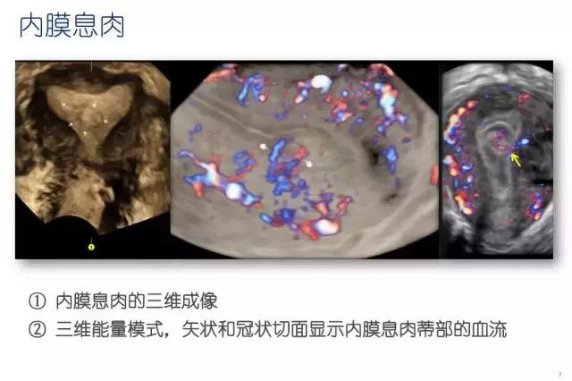 妇科盆腔彩超探头,妇科超声波探头