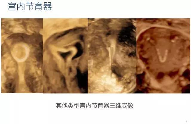 妇科盆腔彩超探头,妇科超声波探头