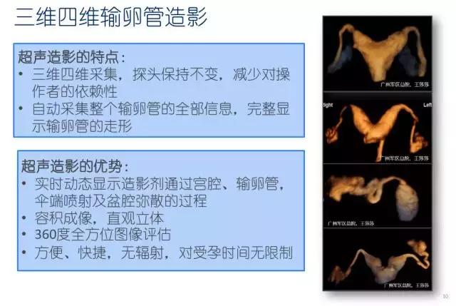 妇科盆腔彩超探头,妇科超声波探头