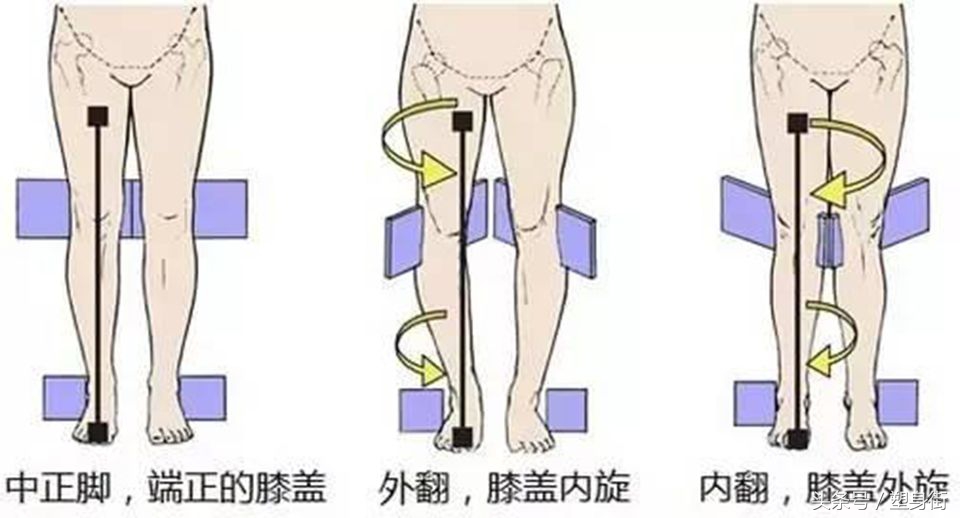 小腿外扩有得救!周冬雨、吴昕也曾腿歪,5种方法可改善