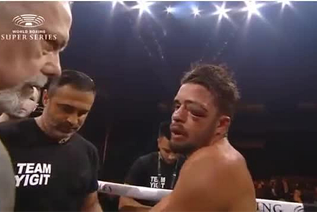 拳击手一拳有几百磅,75公斤职业拳击手一拳多重