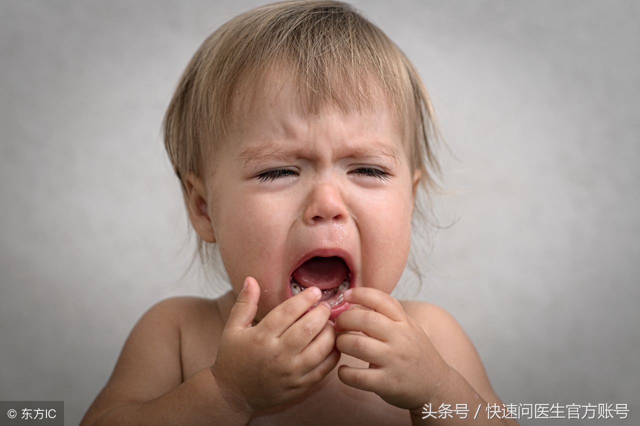 准妈妈孕期注意这五件事，轻松避免宝宝“兔唇”发生