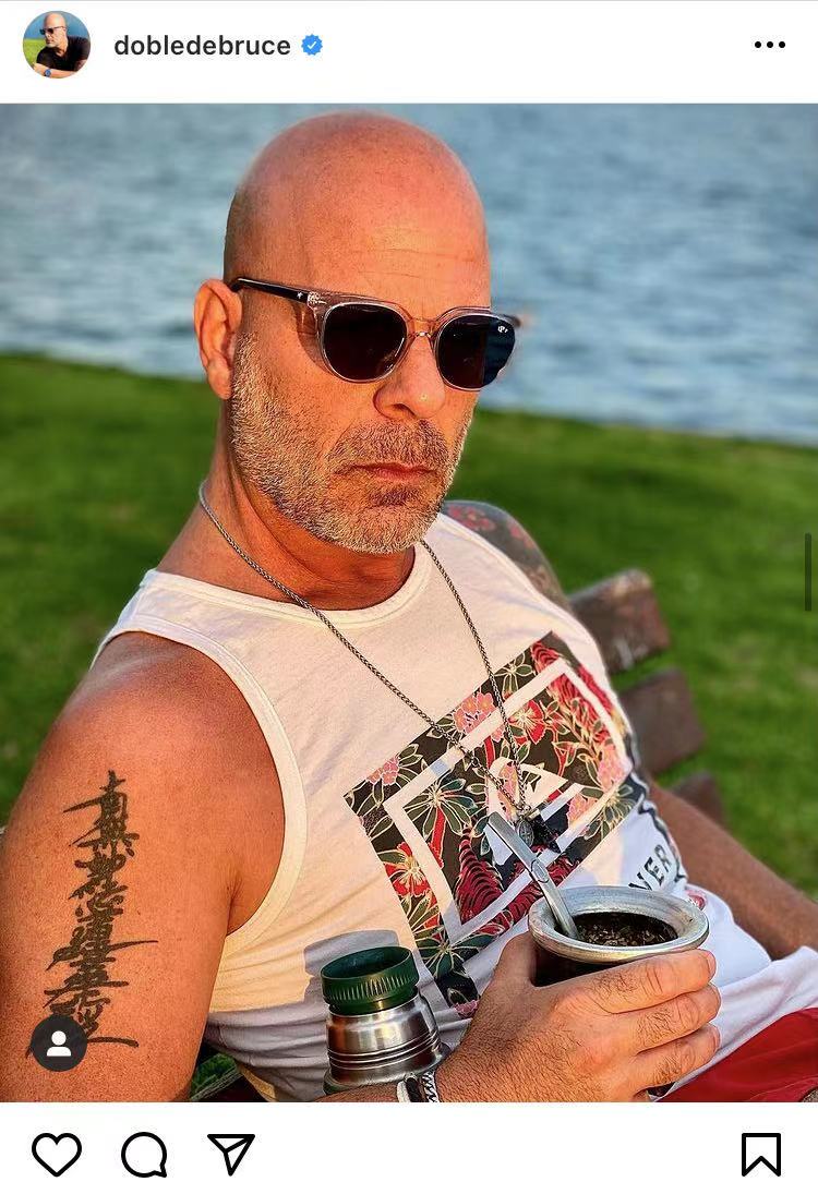 世界最帅的秃头男人,西班牙人秃顶