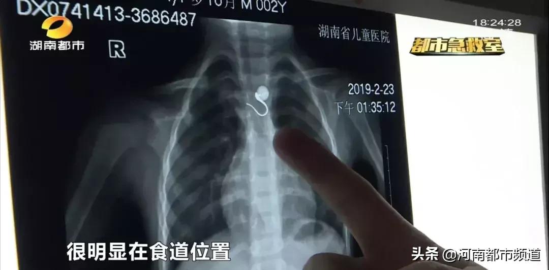 换尿片宝宝老是哭,男孩换尿片突然尿了