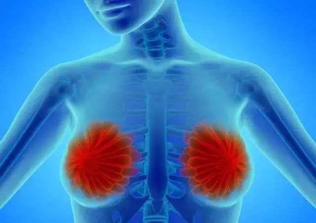 乳腺硬化性腺病易误诊为哪种癌,乳腺包块长得快是什么原因