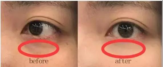 雅诗兰黛日本产的眼霜,用了雅诗兰黛皱纹更明显了