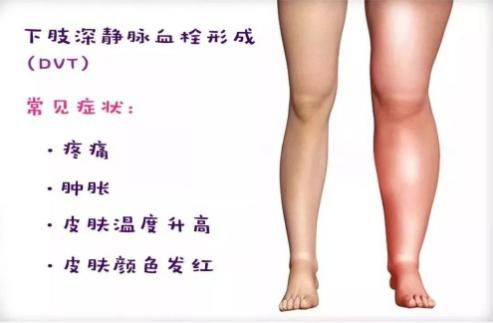 孕妈怎么做预防胎儿缺氧,孕妈如何预防主动脉夹层