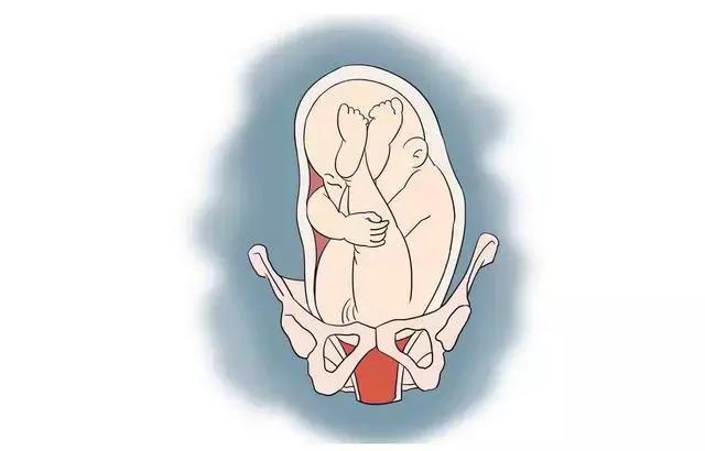 电影中大部分的流产其实都是胎膜早破的现象!