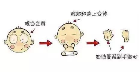 新生儿黄疸护理ppt课件免费,新生儿病理性黄疸在家怎么护理