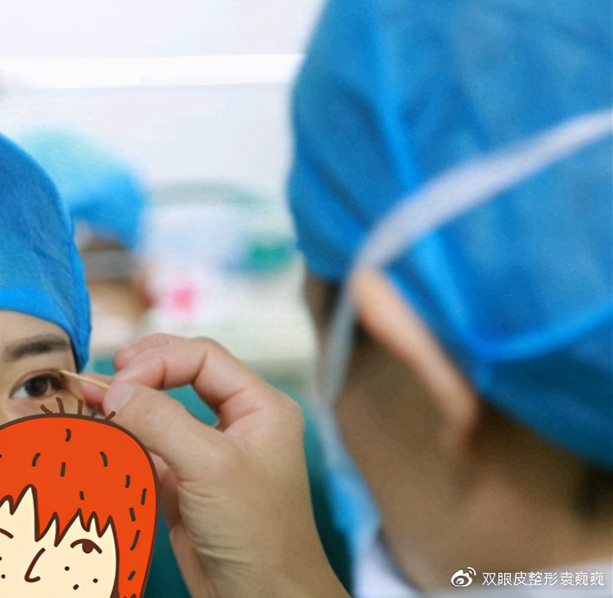 单眼皮怎么贴出平行双眼皮,单双眼皮现实中好看吗