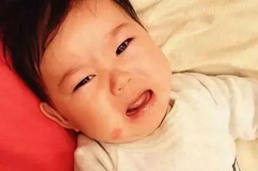 宝宝添加辅食便秘是过敏吗,宝宝添加辅食过敏会腹泻吗