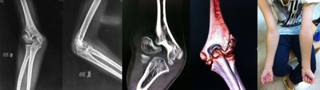 男儿应当兵浴血沙场，别被兵检拒之门外，外科医生谈解决办法