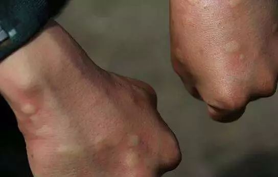 灭蚊灯中的终结者！纯物理灭蚊，无毒无味，孕妇孩子都可用