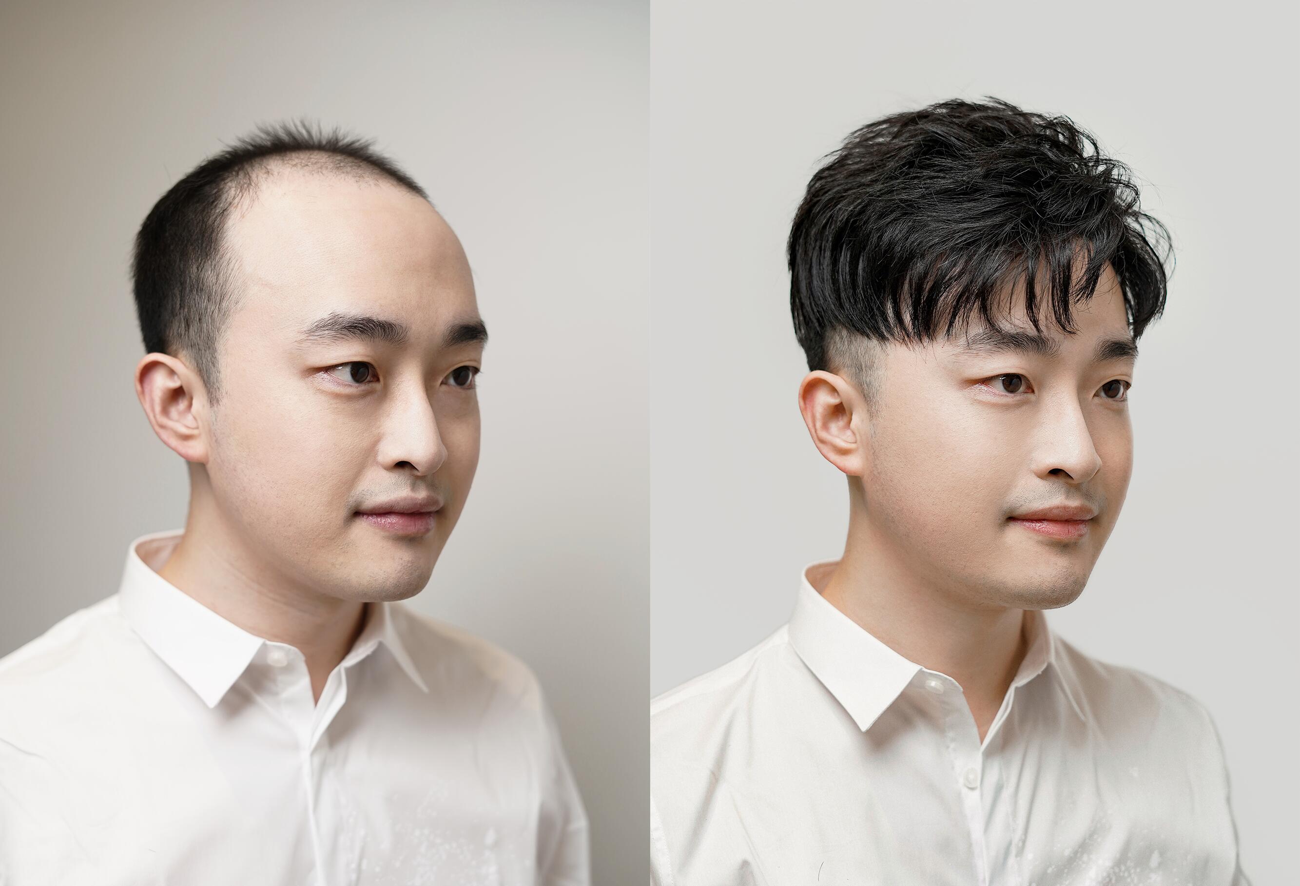 亲，建议你这边把“定制假发”戴上，不然脱单有点难