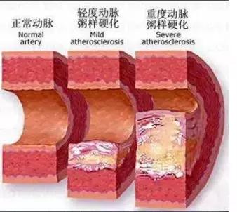科普文的趣味性,趣味性科普文