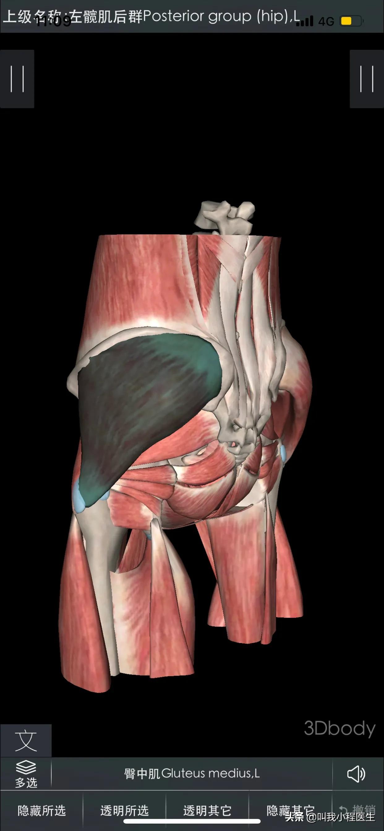 腰椎间盘突出和骨质增生怎样缓解,抗骨质增生片对腰间盘突出有效吗