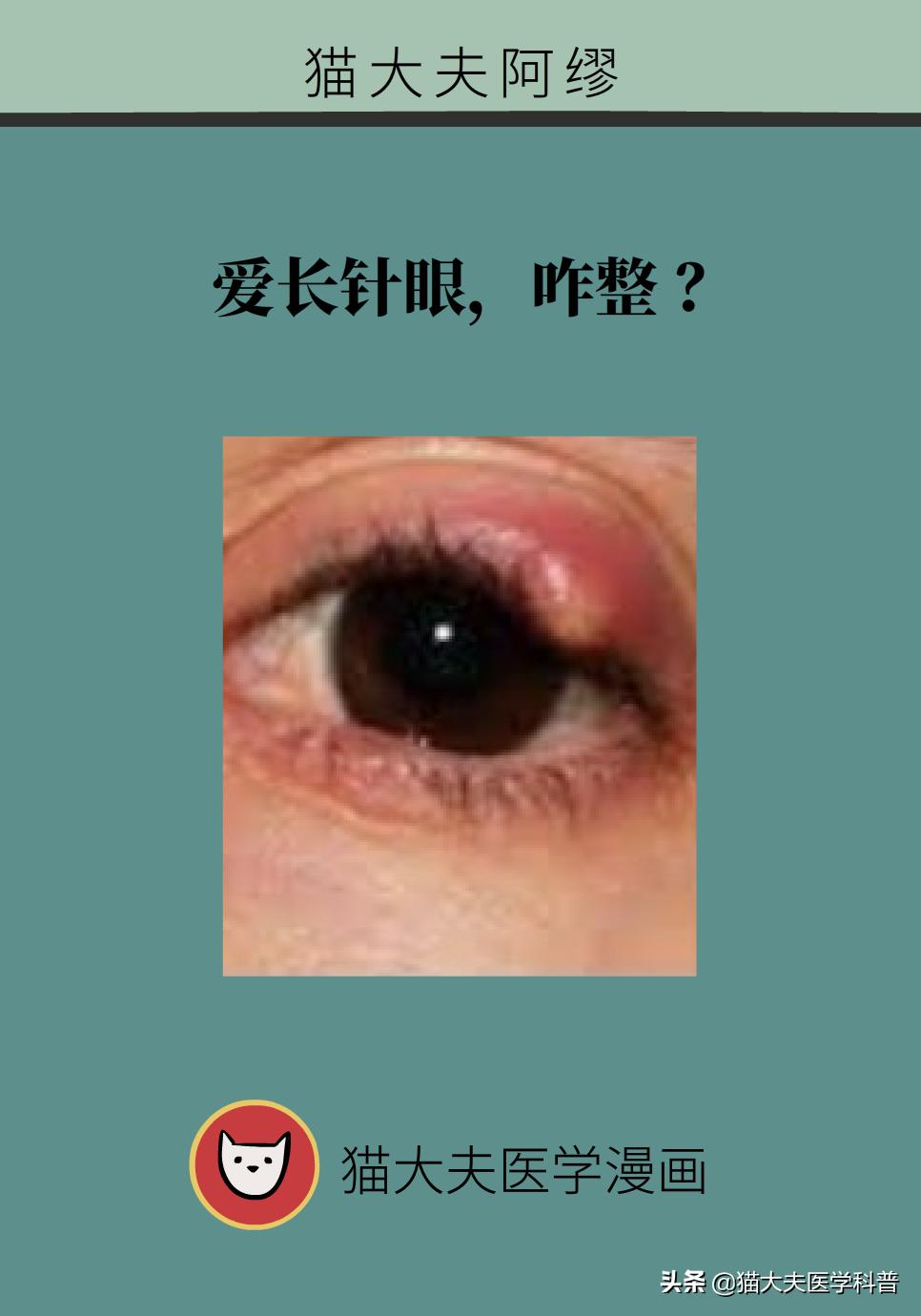 爱长针眼怎么回事,爱长针眼咋整