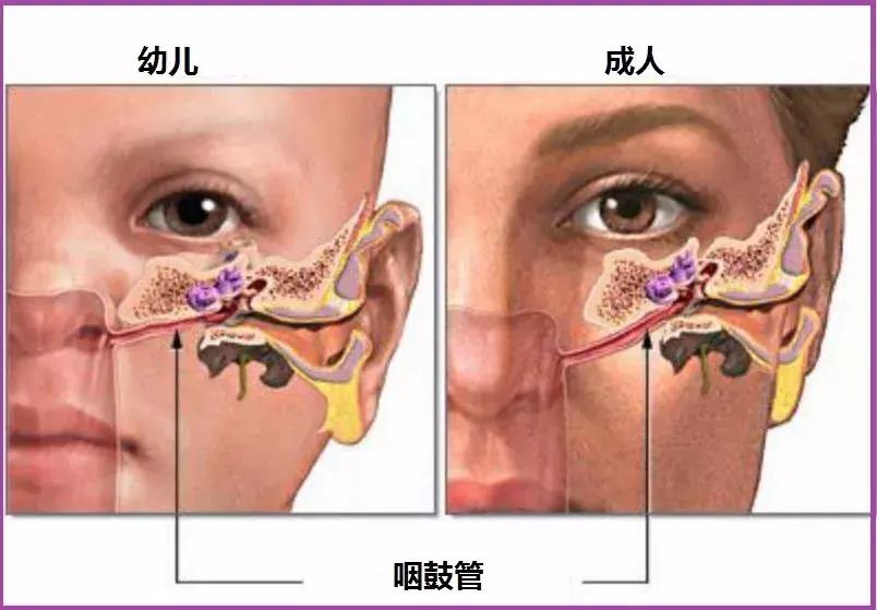 过敏性鼻炎现在喉咙疼吃药不管用,过敏性鼻炎吃药一停就犯了怎么办