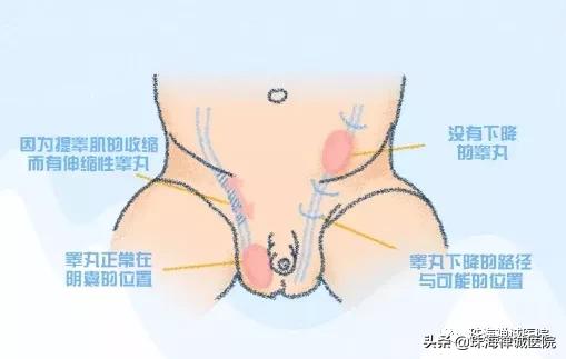 3岁男宝个头小,男婴儿出生只有一个蛋怎么办