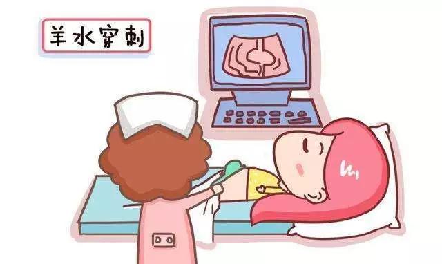 做羊水穿刺的最佳时间,什么时候做羊水穿刺最佳