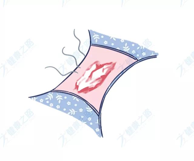 白带在裤头上呈白色正常吗,白带在裤子上干了变黄