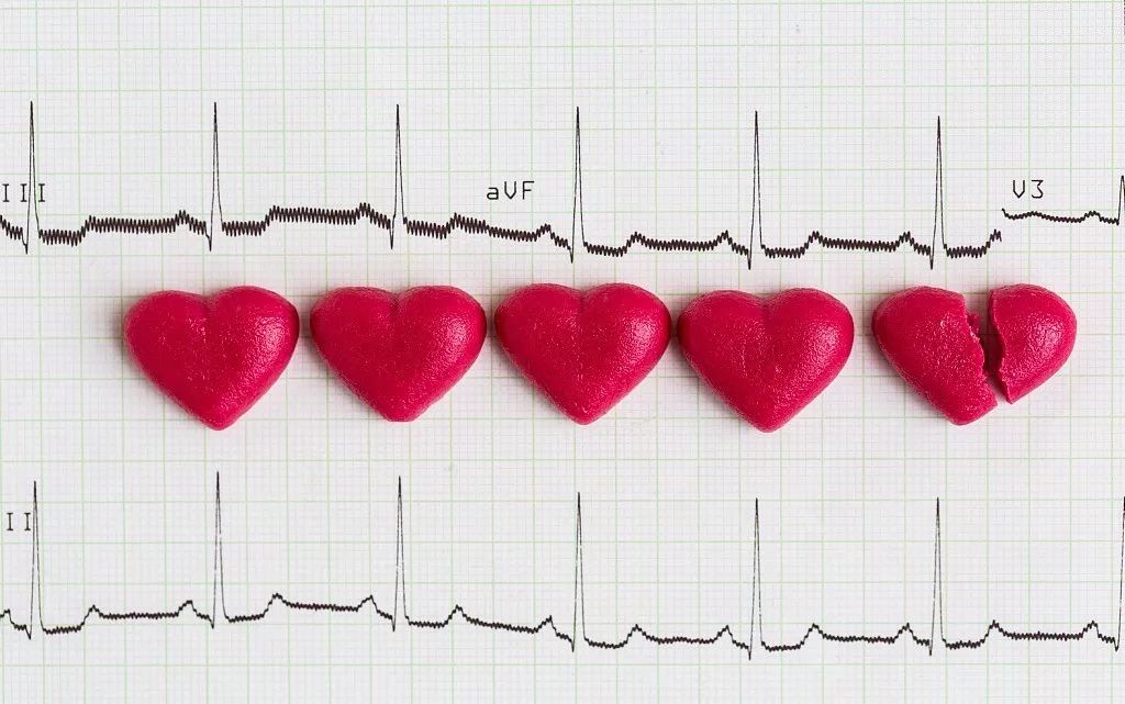 如何辨别真假心肌缺血,心肌缺血的亲身经历