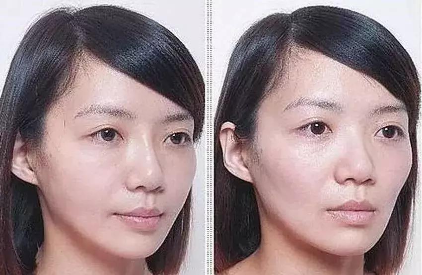 为了变美去整容,整牙堪比整容聊聊我的亲身经历