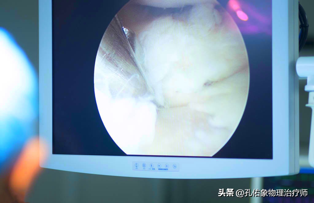 膝盖痛是什么病引起的怎么治,膝盖疼致病原因