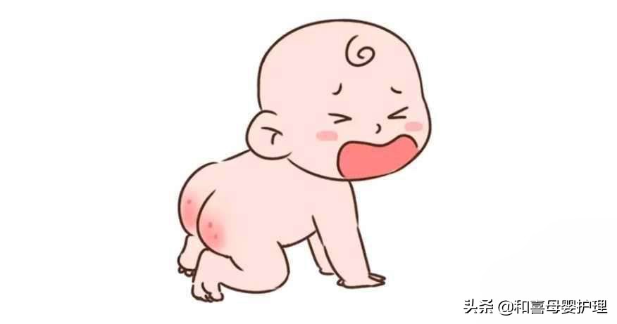 宝宝红屁股快速有效的方法,宝宝红屁股了怎么弄好得快